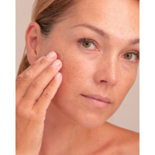 Skinglow Anti dark spot patch with arbutin, 30 KPL